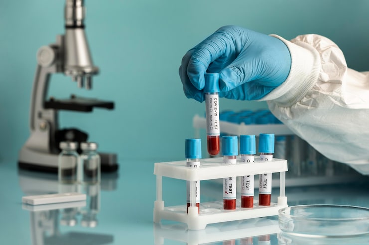 Foto grátis mão com luvas de proteção segurando amostras de sangue para teste de covid