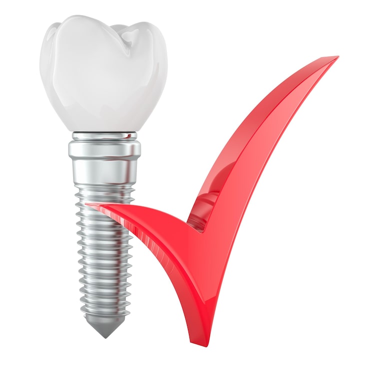 PSD kırmızı onay işaretli dental implant 3d render